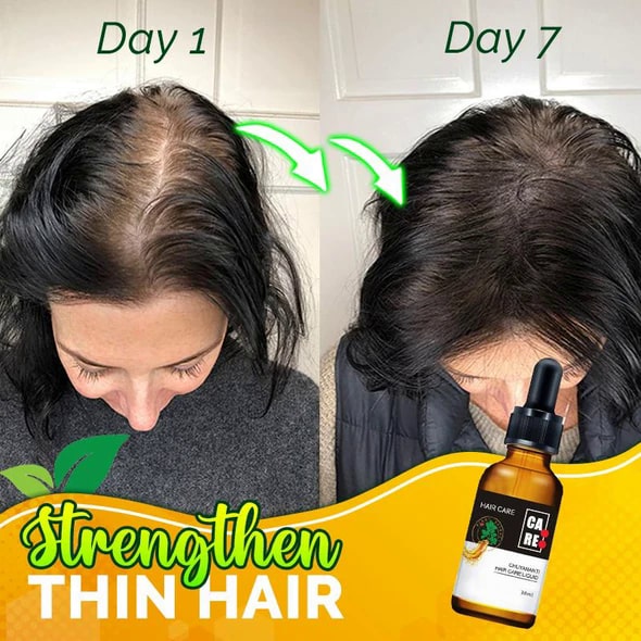 10X-Regro مصل الشعر القوي