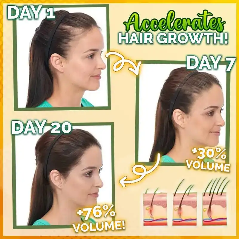 10X-Regro مصل الشعر القوي - الصورة 2