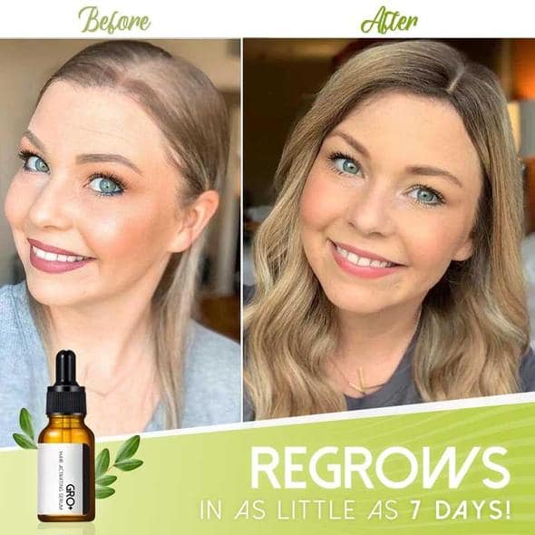 مصل منشط للشعر من جرو+ - الصورة 3