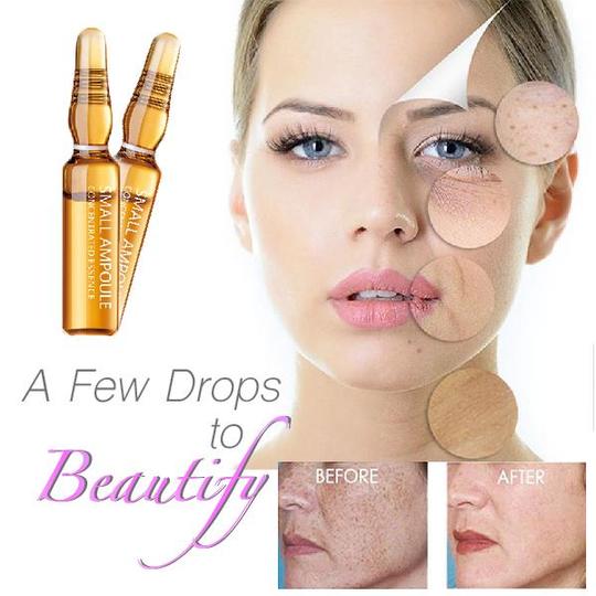 مصل أمبولة - الصورة 3