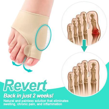 مصحح ورم القدم الطبيعي - الصورة 2