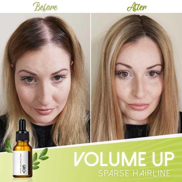 مصل منشط للشعر من جرو+ - الصورة 4