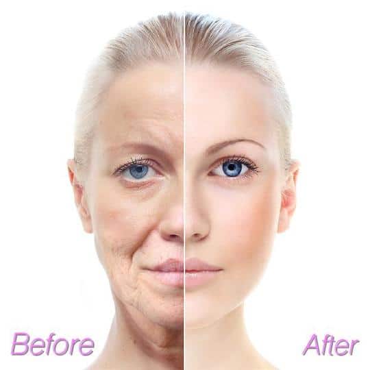 مصل أمبولة - الصورة 4