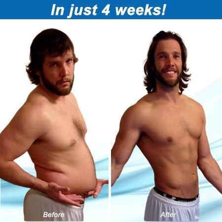 تقليص أقراط التخسيس المغناطيسية - الصورة 4