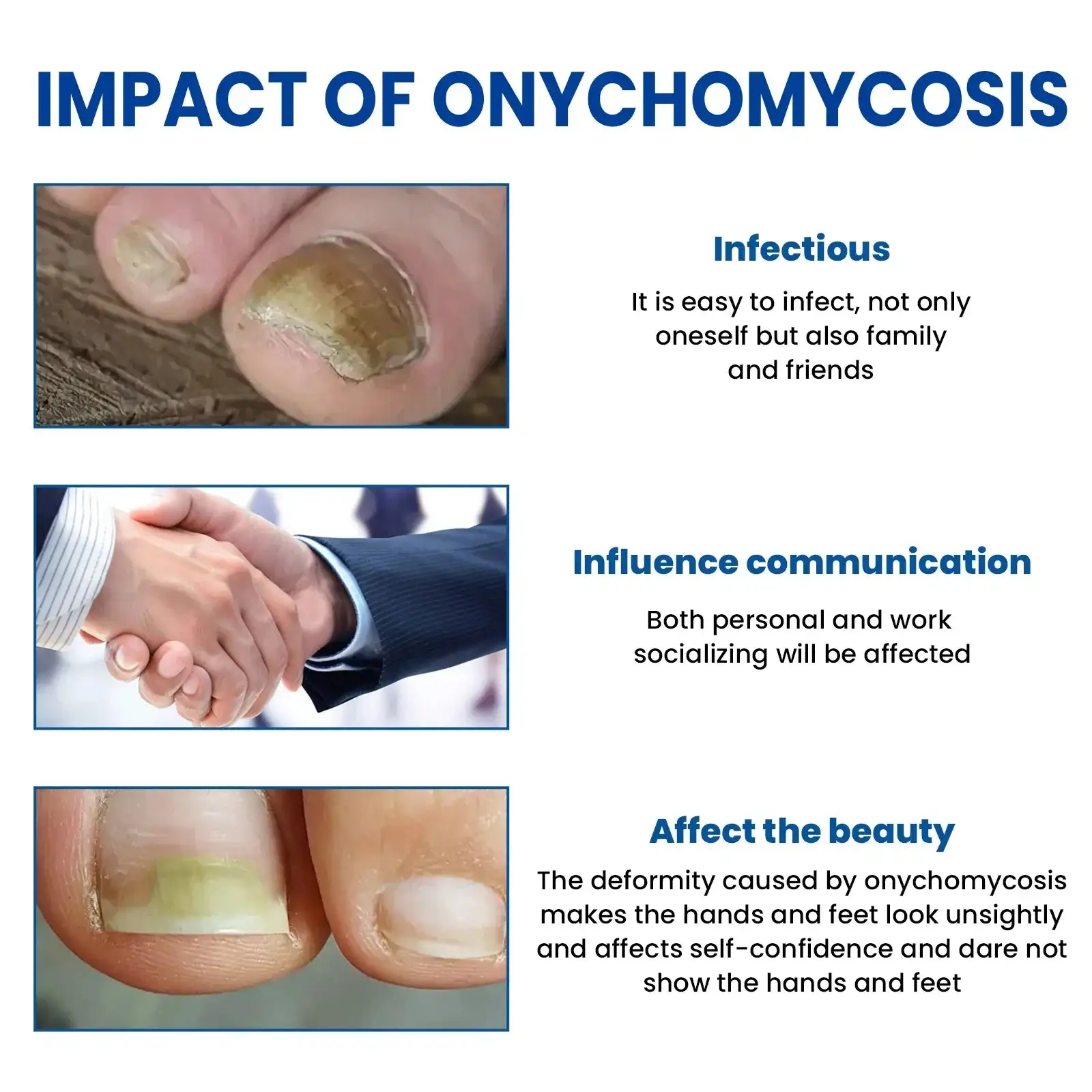بقع إصلاح الأظافر الفطرية - الصورة 2