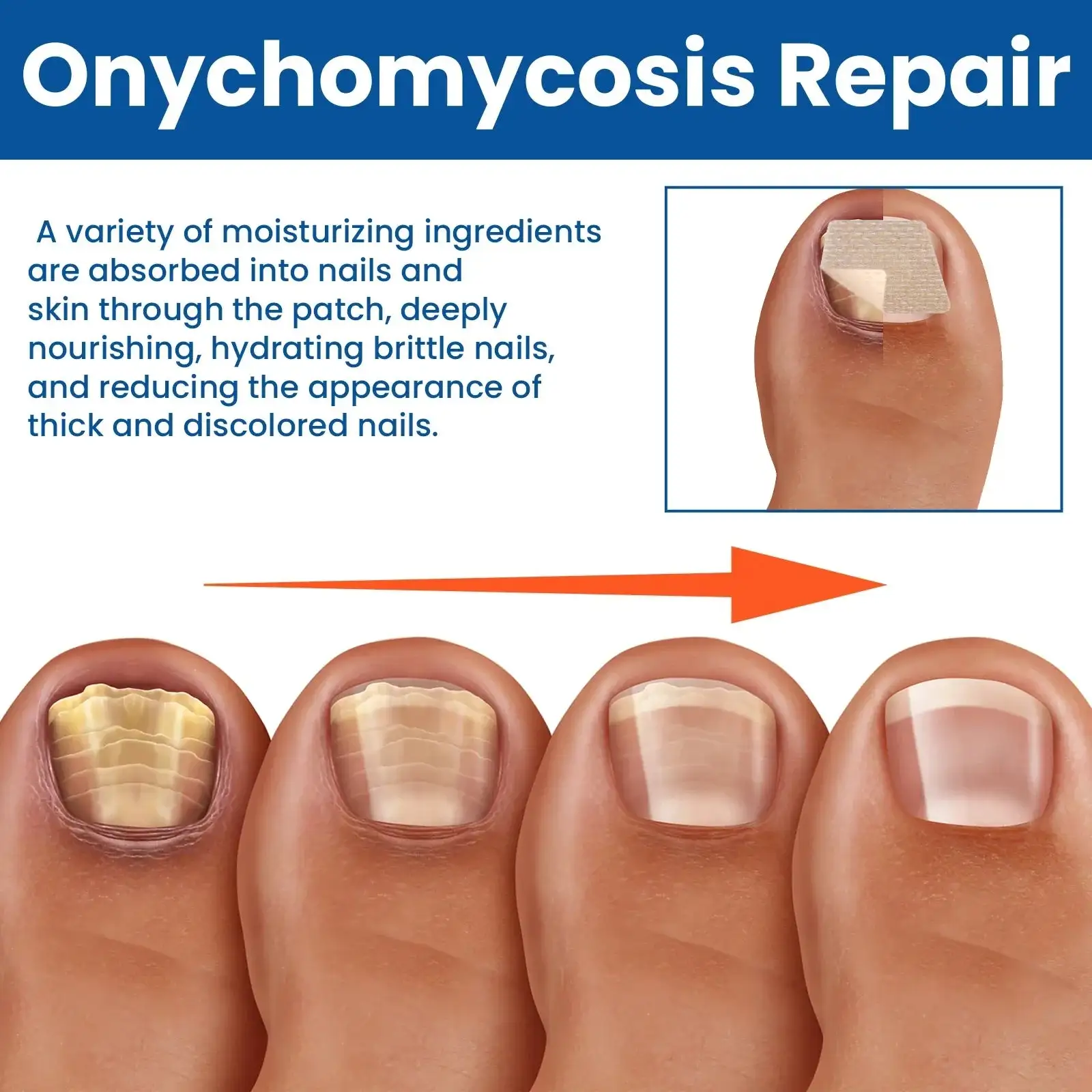 بقع إصلاح الأظافر الفطرية - الصورة 4
