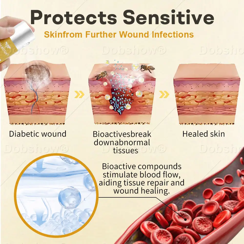 جلوكو شيلد بخاخ الجروح بسم النحل - الصورة 3