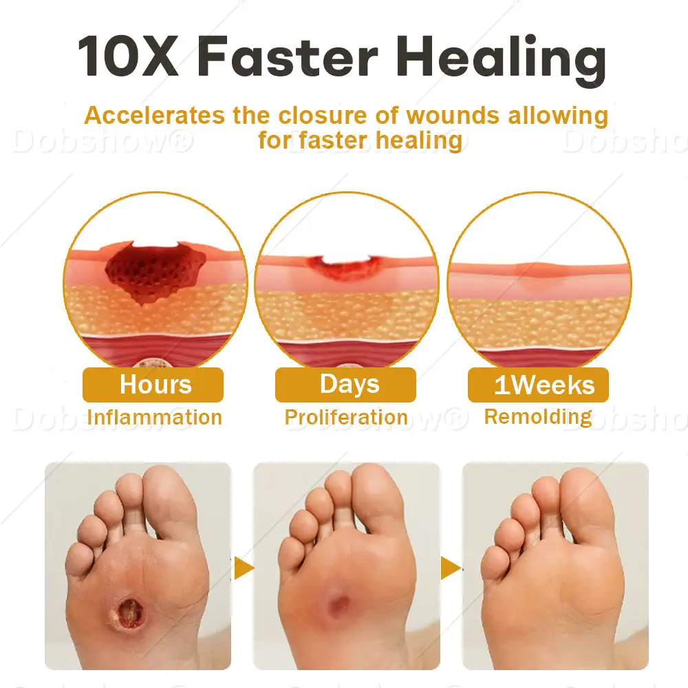 جلوكو شيلد بخاخ الجروح بسم النحل - الصورة 4