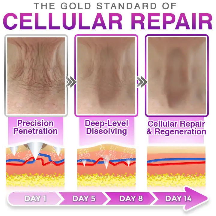 رقعة مضادة للشيخوخة 3 في 1 بإبر دقيقة - الصورة 3