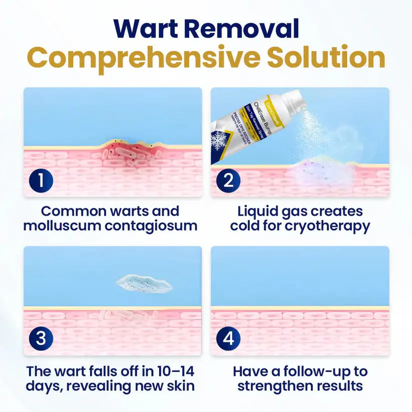 ChillErase نتوء & رذاذ تجديد علامات الجلد - الصورة 4