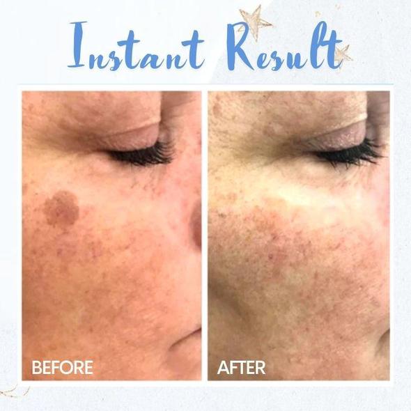 قلم إزالة البقع - الصورة 3