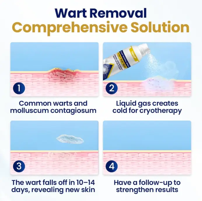 رذاذ تجديد نتوء تشيليك - الصورة 3